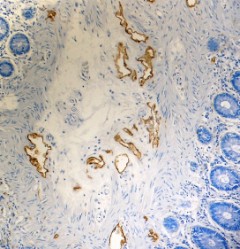 Purified anti-Podoplanin (Lymphatic Endothelial Marker) Antibody (916605)
