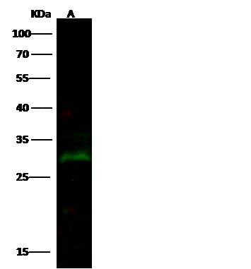 PRTFDC1 Monoclonal Antibody (AN200139P)