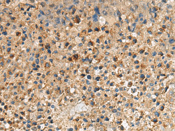 CXCR5 Polyclonal Antibody (E-AB-53249)