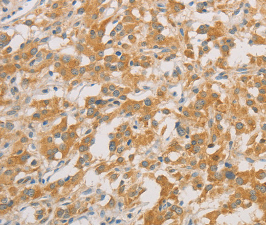 ZWINT Polyclonal Antibody (E-AB-10889)