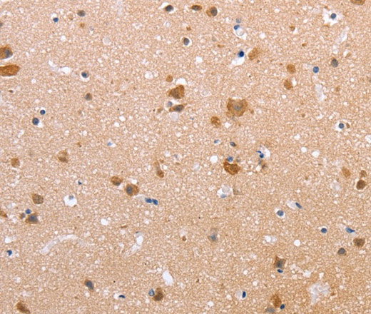 Claudin 10 Polyclonal Antibody (E-AB-15679)