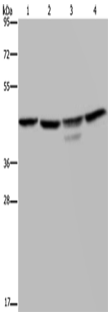 CSNK2A1 Polyclonal Antibody (E-AB-14001)