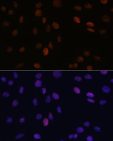 PSME3 Polyclonal Antibody (E-AB-64305)