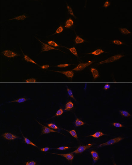PAK3 Polyclonal Antibody (E-AB-66994)