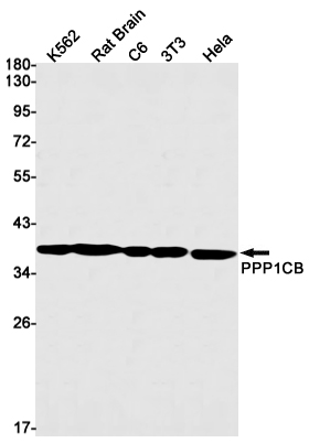 Recombinant PP1C beta Monoclonal Antibody (E-AB-81598)