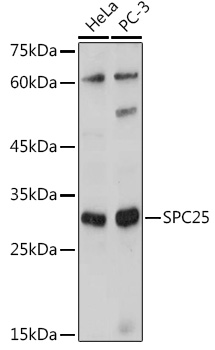 SPC25 Polyclonal Antibody (E-AB-90230)