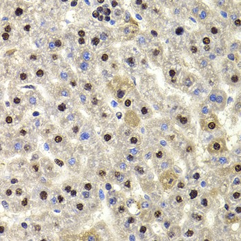HIRIP3 Polyclonal Antibody (E-AB-61469)