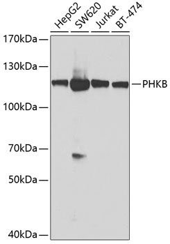 PHKB Polyclonal Antibody (E-AB-62868)