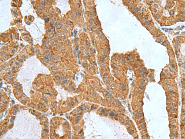 ITGB1BP1 Polyclonal Antibody (E-AB-19162)