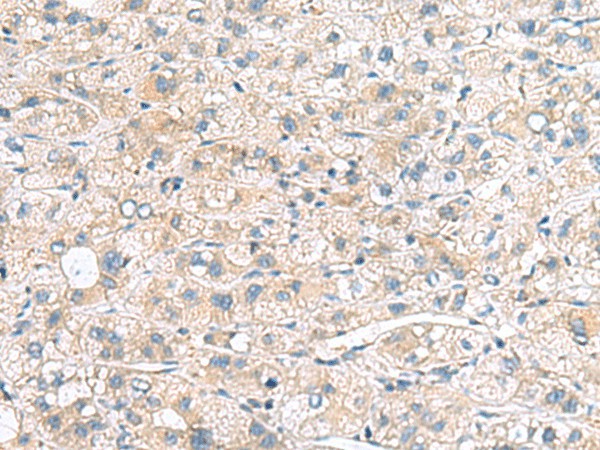 MYL1 Polyclonal Antibody (E-AB-53047)