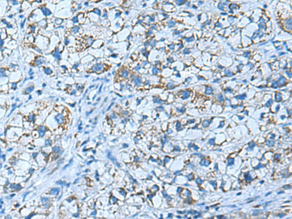 GUCA1A Polyclonal Antibody (E-AB-53078)