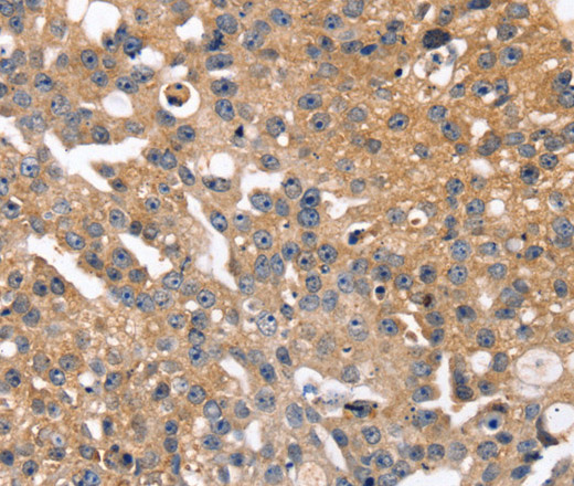 SLC2A2 Polyclonal Antibody (E-AB-12475)
