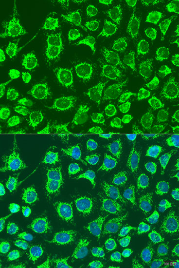 GYPB Polyclonal Antibody (E-AB-66410)