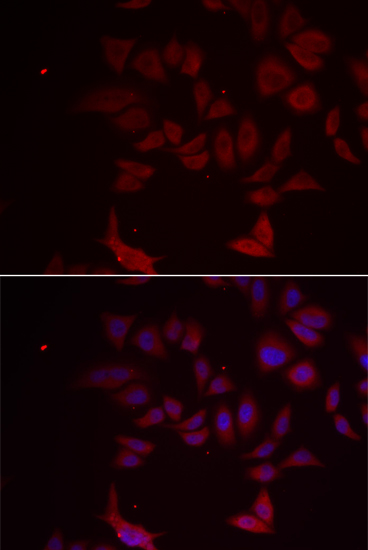 RPL11 Polyclonal Antibody (E-AB-64703)