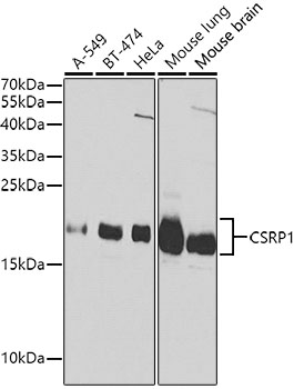 CSRP1 Polyclonal Antibody (E-AB-60169)