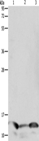 PFN1 Polyclonal Antibody (E-AB-12623)