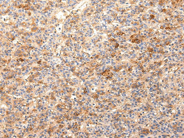 ZNF365 Polyclonal Antibody (E-AB-17651)