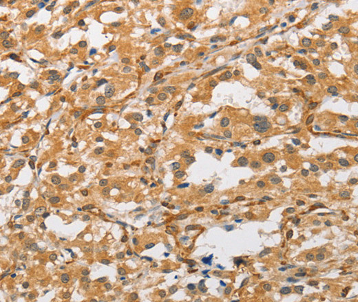ARMCX1 Polyclonal Antibody (E-AB-10839)