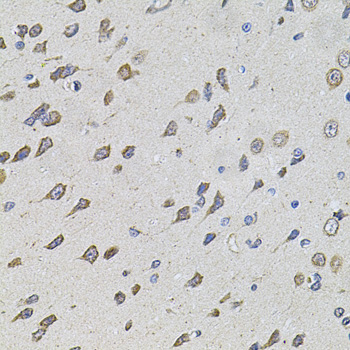 FoxO3a Polyclonal Antibody (E-AB-62081)