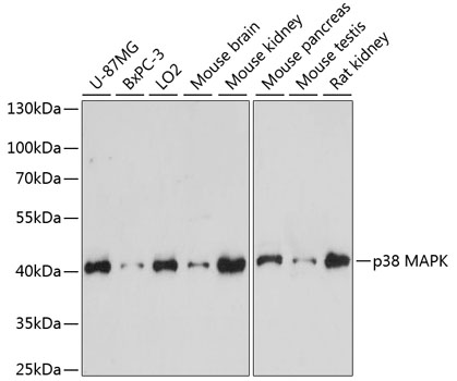 p38 MAPK Polyclonal Antibody (E-AB-66279)