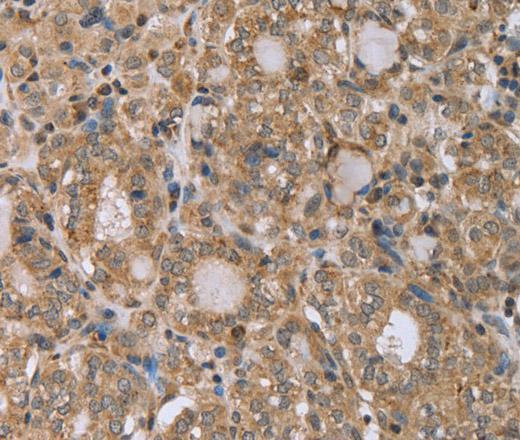 RAB39B Polyclonal Antibody (E-AB-16644)