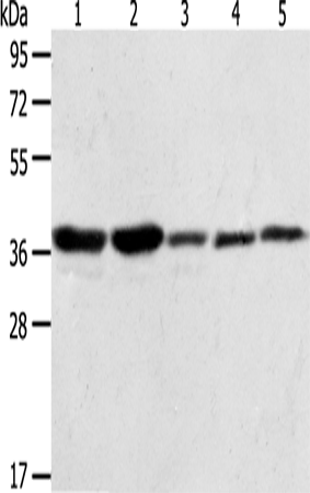 ANXA1 Polyclonal Antibody (E-AB-13901)