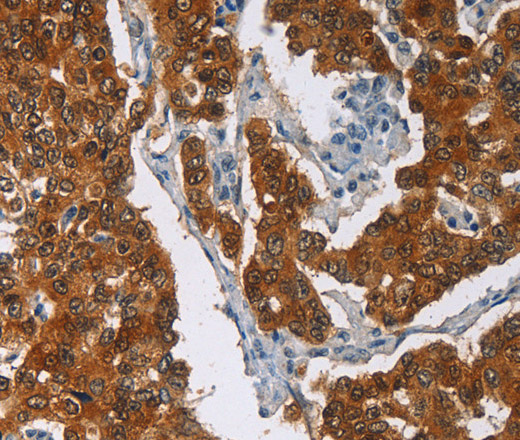CRABP2 Polyclonal Antibody (E-AB-11101)