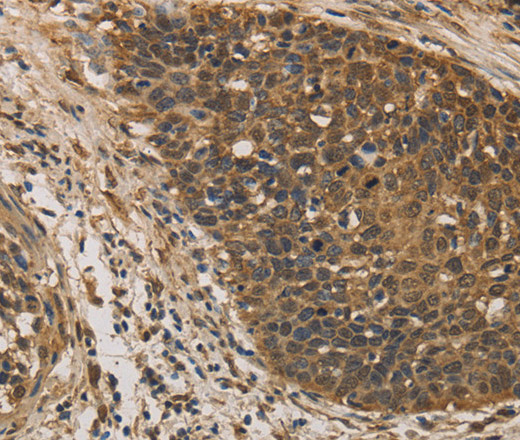 DACH1 Polyclonal Antibody (E-AB-14926)
