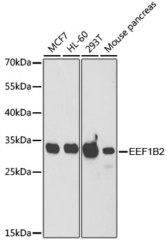 (KO Validated) EEF1B2 Polyclonal Antibody (E-AB-61227)