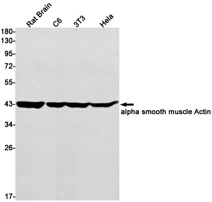 Recombinant alpha Smooth Muscle Actin Monoclonal Antibody (E-AB-81457)