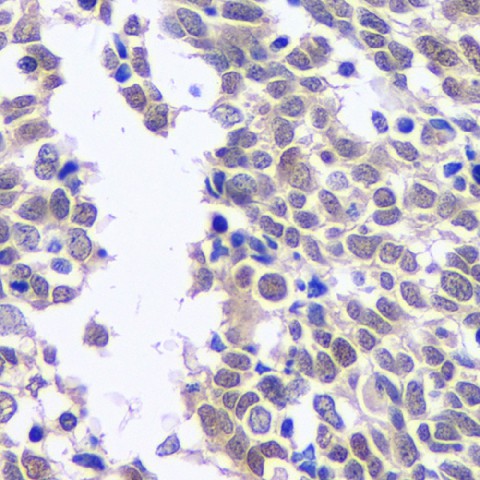 CREB1 Polyclonal Antibody (E-AB-70099)