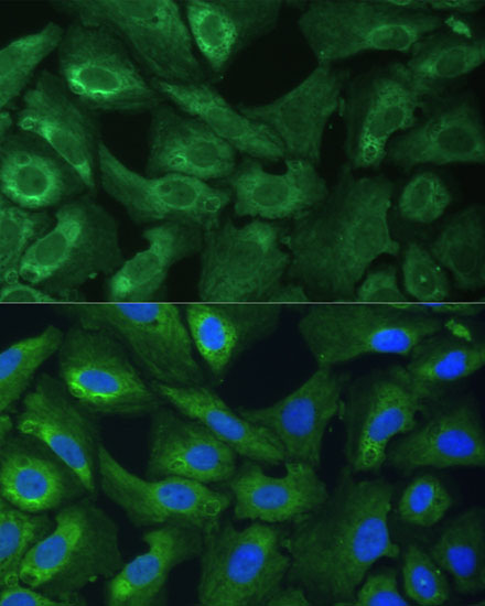 EIF3G Polyclonal Antibody (E-AB-62283)