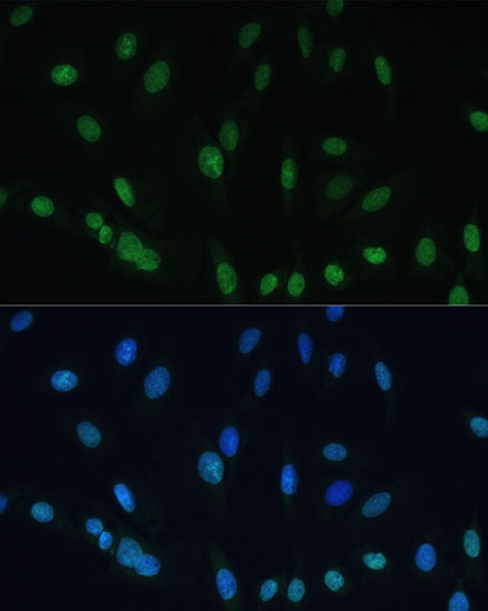 Histone H2AX Polyclonal Antibody (E-AB-67407)