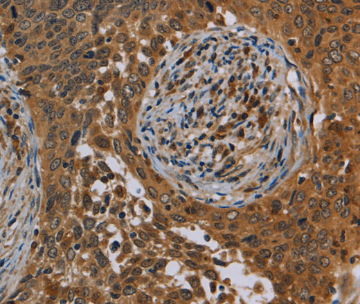 OSM Polyclonal Antibody (E-AB-13474)