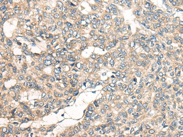 LRP1B Polyclonal Antibody (E-AB-19566)