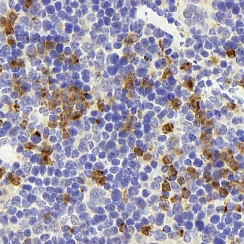 CD177 Polyclonal Antibody (E-AB-70185)