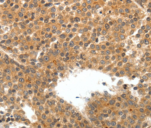 TEK Polyclonal Antibody (E-AB-12907)