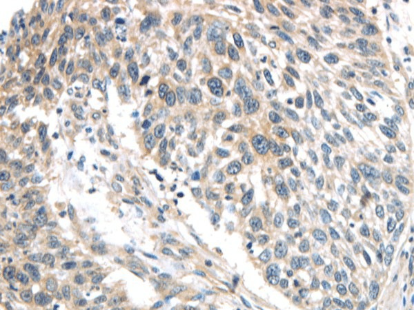 IQGAP2 Polyclonal Antibody (E-AB-17343)
