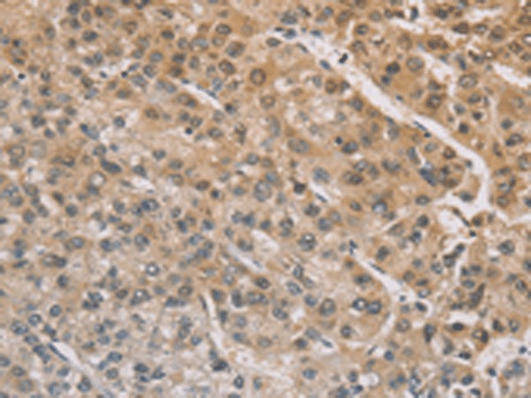 ZIC2 Polyclonal Antibody (E-AB-53238)