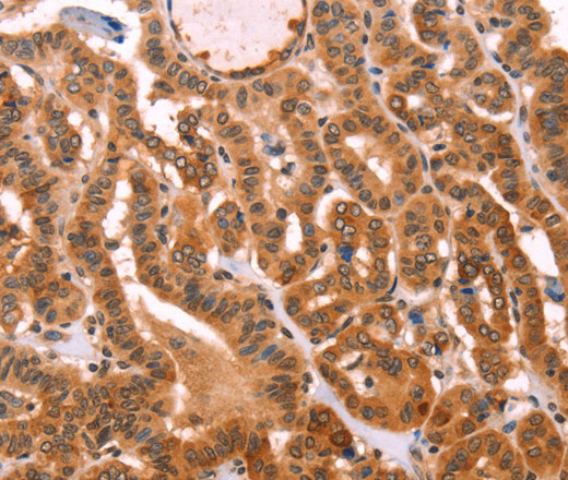 PROS1 Polyclonal Antibody (E-AB-14444)