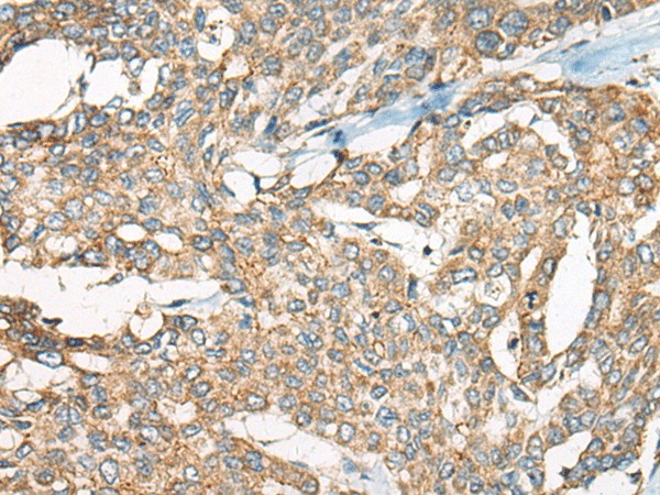 YEATS2 Polyclonal Antibody (E-AB-19569)