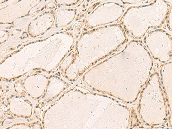RFX6 Polyclonal Antibody (E-AB-52780)