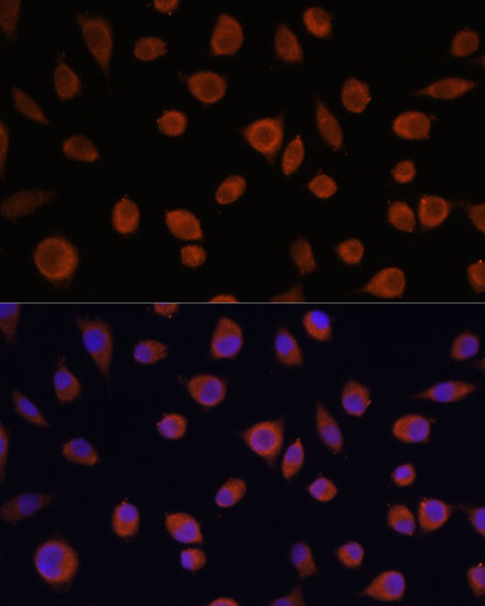 ZCCHC3 Polyclonal Antibody (E-AB-67087)