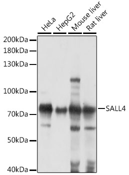 Sall4 Polyclonal Antibody (E-AB-91467)