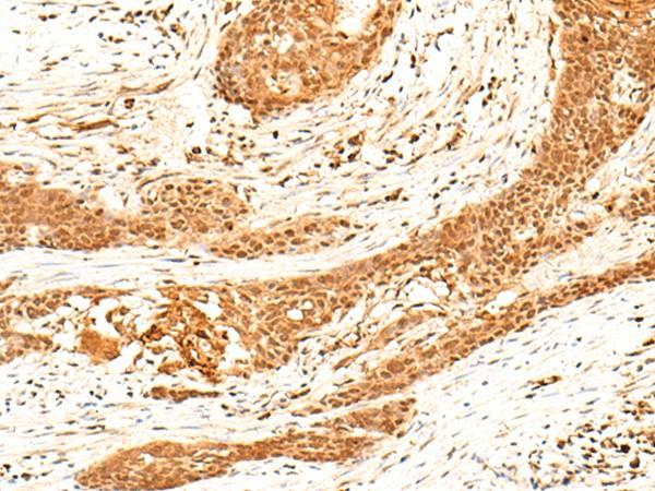 HNF4A Polyclonal Antibody (E-AB-18087)