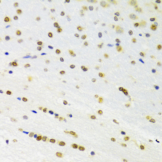 DOK1 Polyclonal Antibody (E-AB-61064)