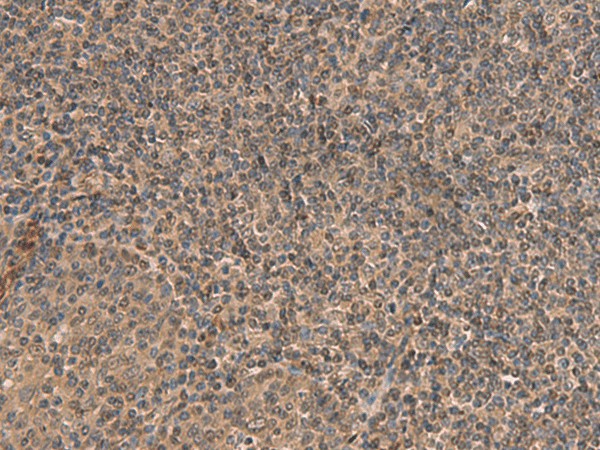 HEBP2 Polyclonal Antibody (E-AB-18940)