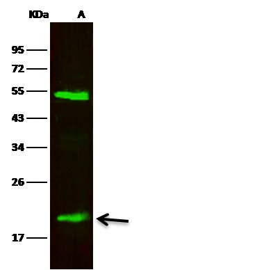 Recombinant LCN2/NGAL Monoclonal Antibody (AN300307P)