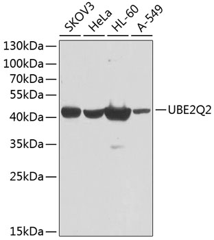 UBE2Q2 Polyclonal Antibody (E-AB-62558)