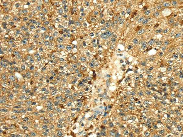 Cathepsin H Polyclonal Antibody (E-AB-16961)
